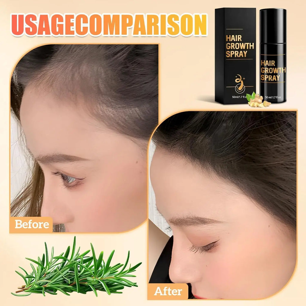 50ml Hair Growth Spray Thicker. Fuller. Stronger. Naturally. - Zenflow Active