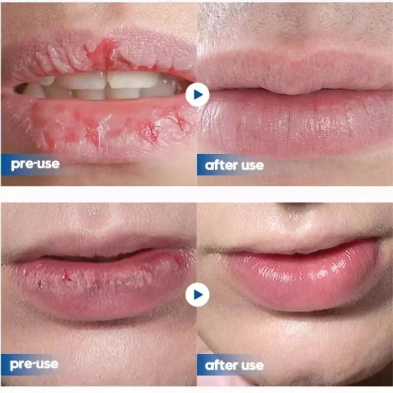 SADOER Moisturising Lip Balm Stick for Dry, Chapped Lips - Zenflow Active